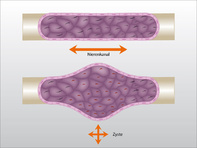 Entstehung von Zystennieren